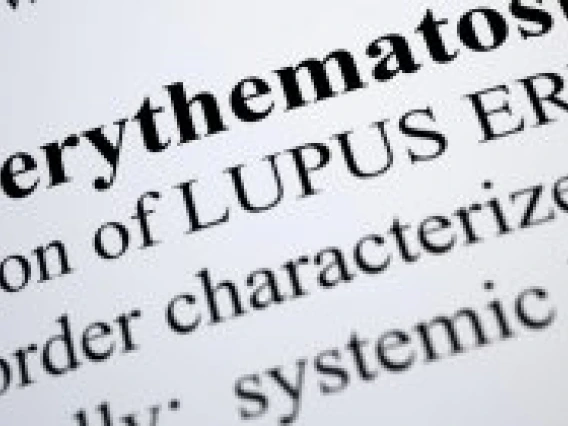 text describing Lupus