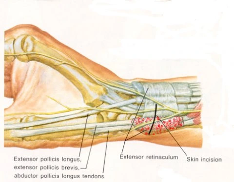 xray image of a wrist