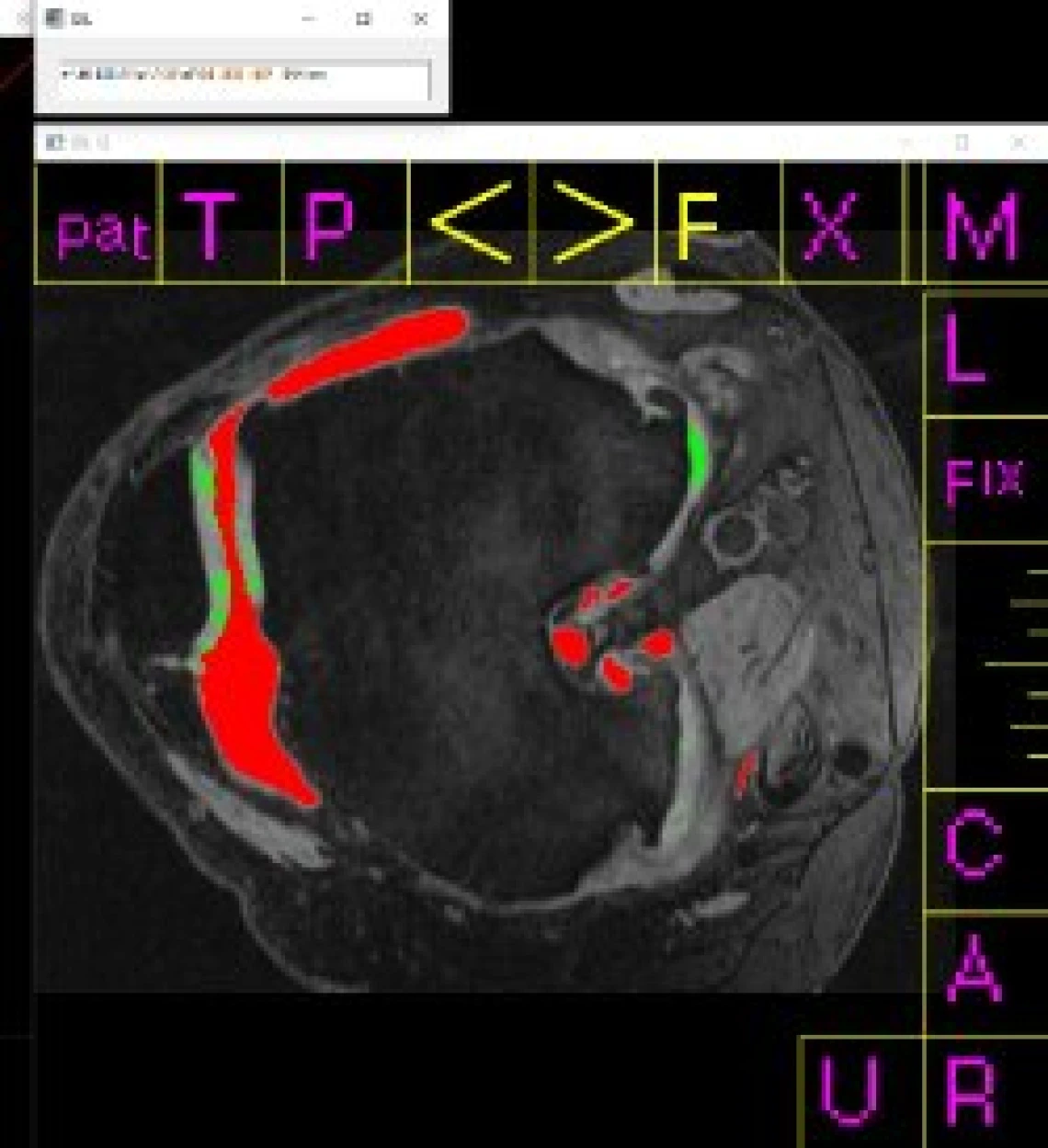 treatable tissues image