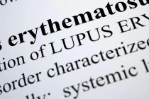 text describing Lupus